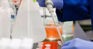 Esperto, a 40 anni dalla scoperta dell’Hiv ancora milioni di persone infettate e nessun vaccino