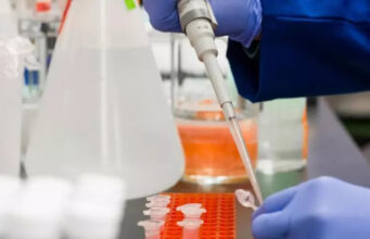 Esperto, a 40 anni dalla scoperta dell’Hiv ancora milioni di persone infettate e nessun vaccino