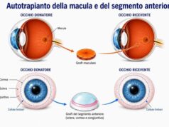 Dopo 5 anni di cecità, torna a vedere con un trapianto da un occhio all’altro
